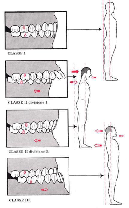 Controllo posturale