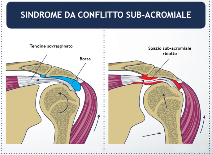 Osteopatia per lo sport