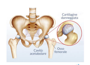 Osteopatia